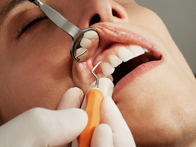Leczenie urazów zębów z chirurgiem stomatologicznym w Warszawie